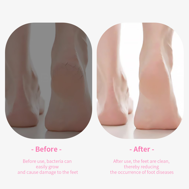 Exfoliating Pedicure Pumice Stone