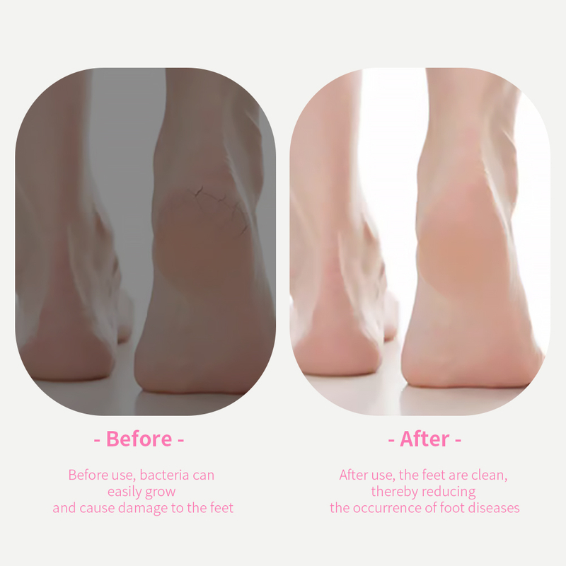 Dead Skin Shaving Board File Pedicure Knife Suit